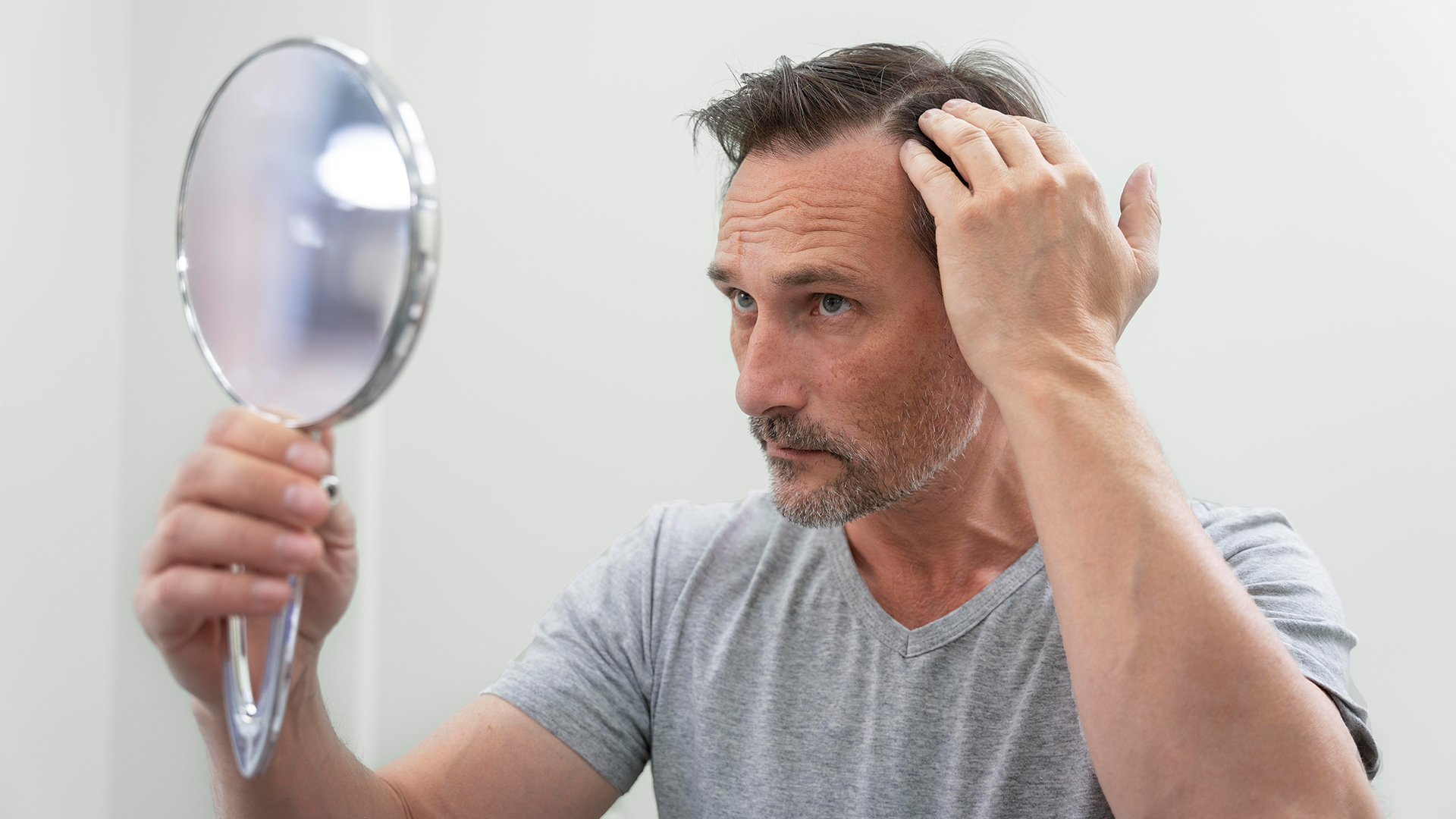 Natural Hair Transplant Results